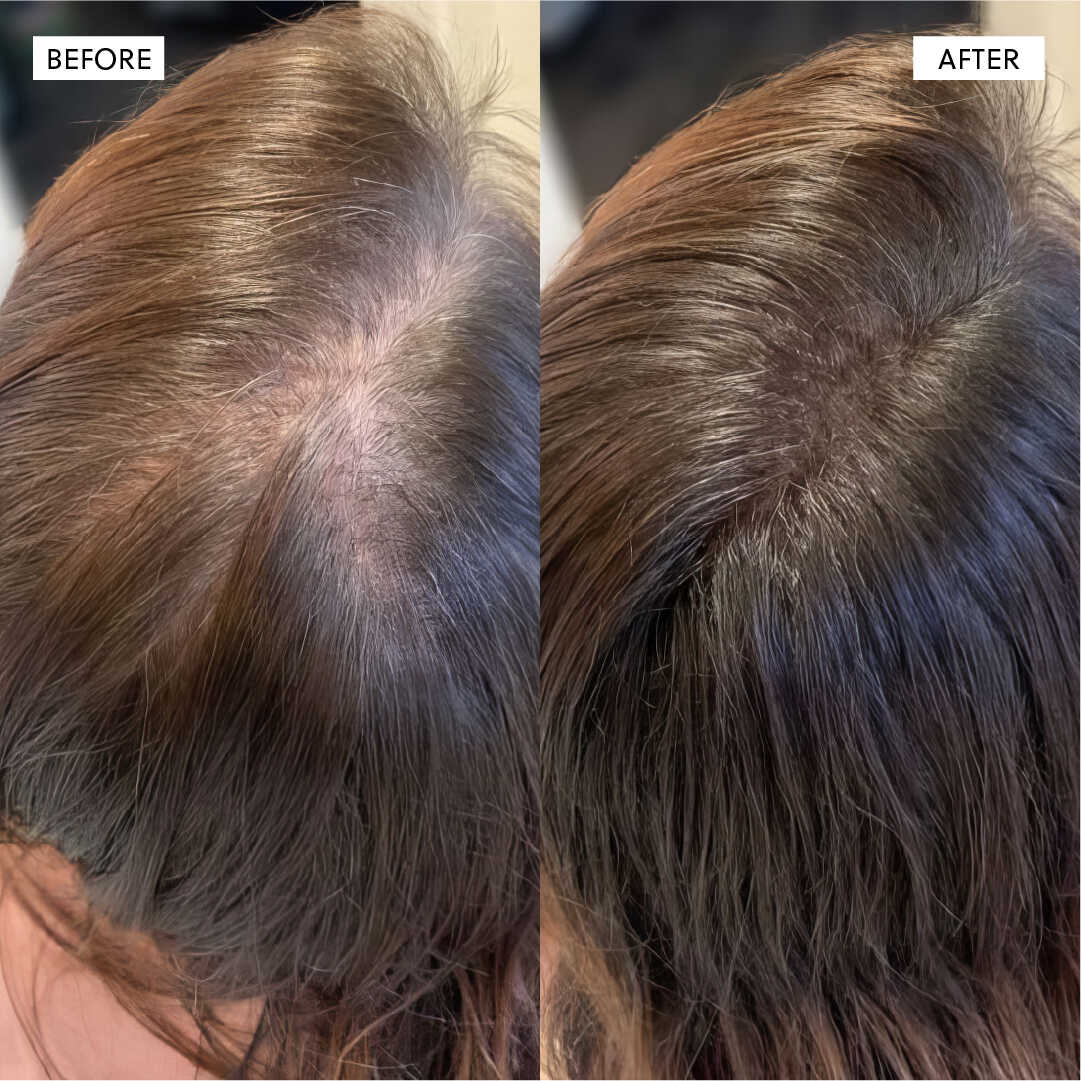 Hair Growth Oil spray– 50ml