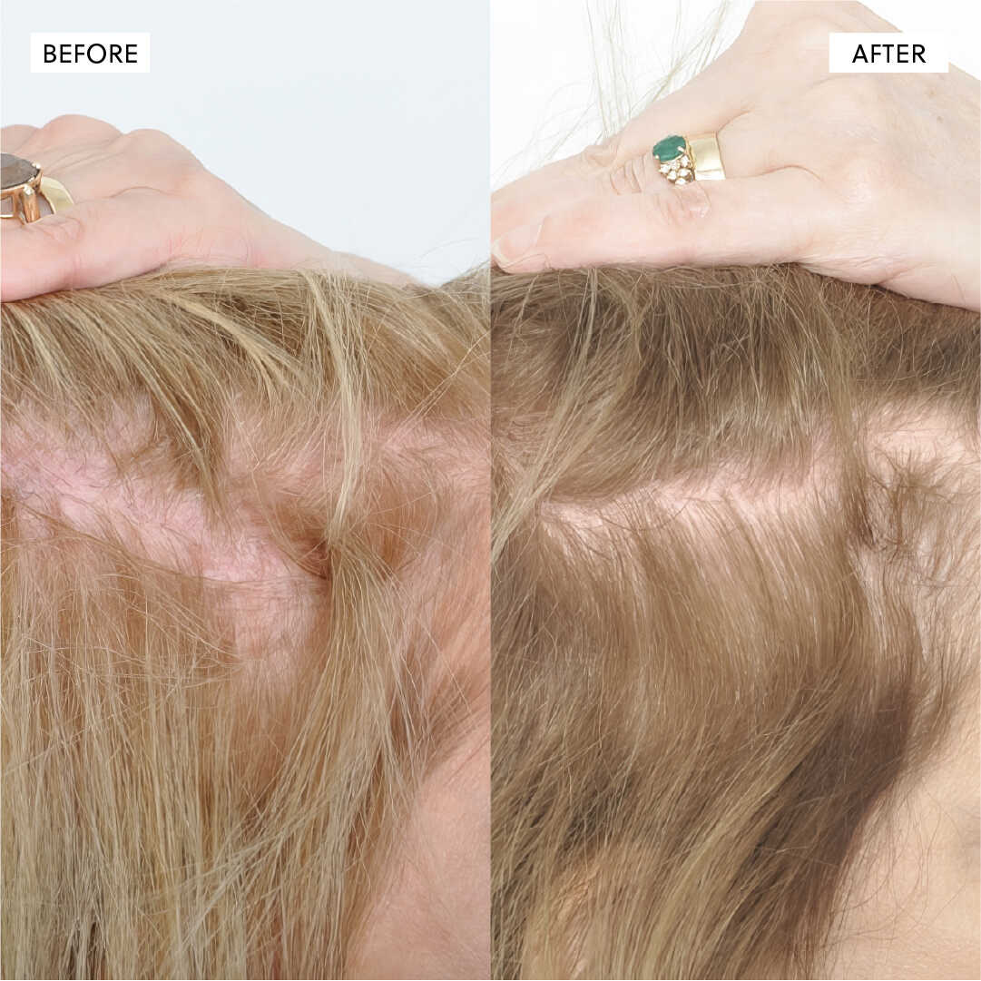 Hair Growth Oil spray– 50ml