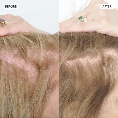 Hair Growth Oil spray– 50ml