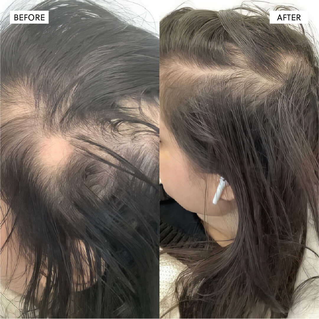 Hair Growth Oil spray– 50ml