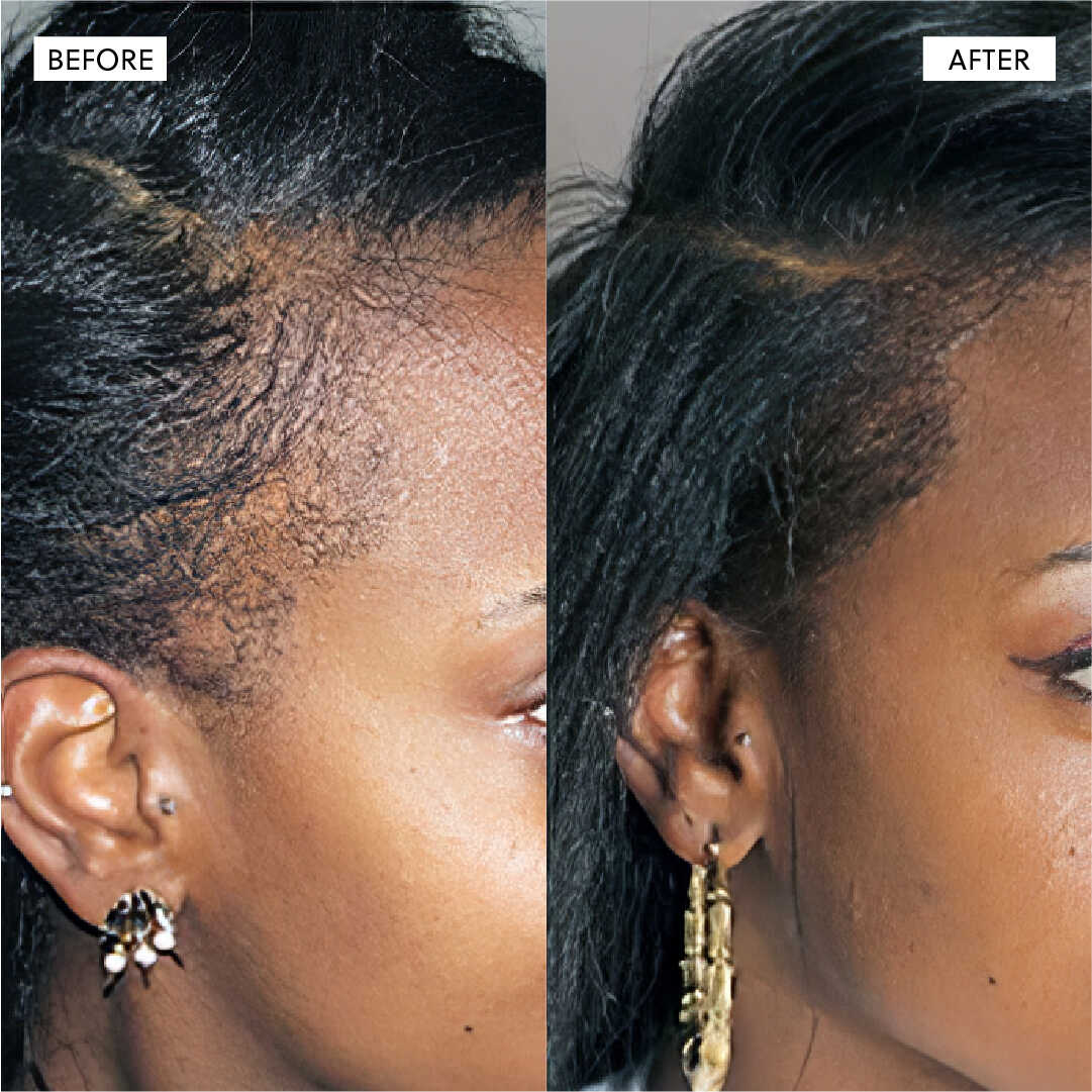 Hair Growth Oil spray– 50ml