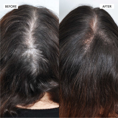 Hair Growth Oil spray– 50ml